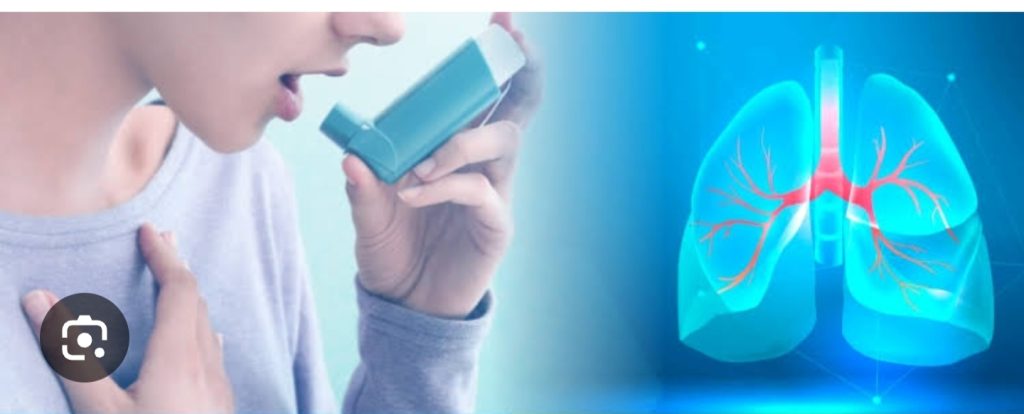 Asthma